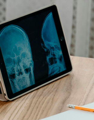 Máster Universitario en Neuropsicología Clínica